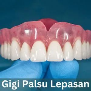 Gigi Palsu Lepasan