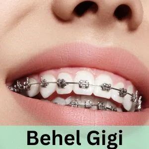 behel gigi terdekat