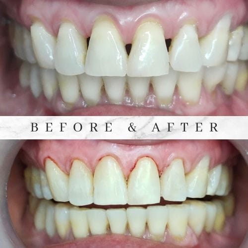 before after pauline