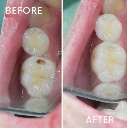 before after stephanie