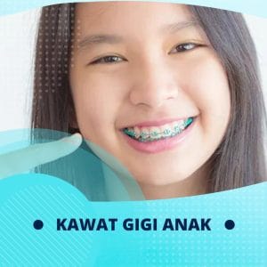 kawat gigi anak