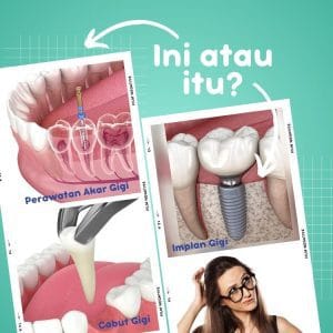 perawatan akar gigi vs cabut gigi