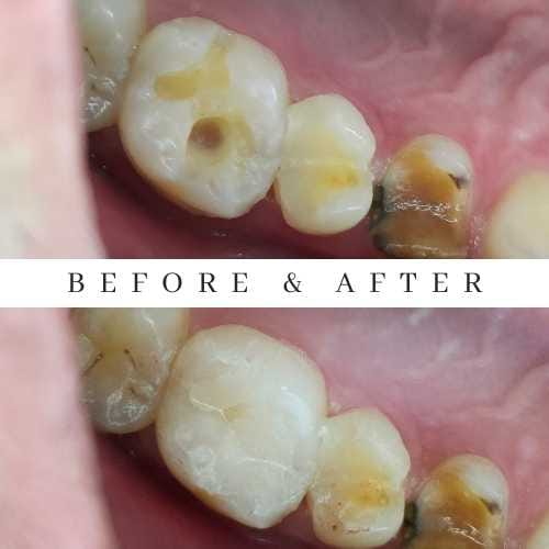 tambal michael limbowo