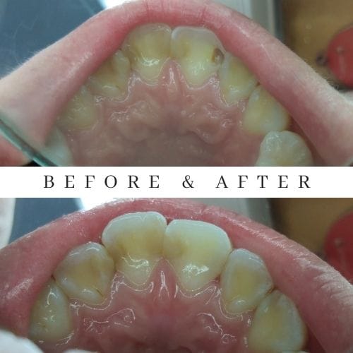 tambal michelle gafrila